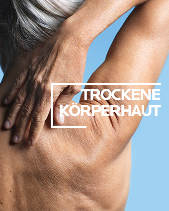 Trockene Körperhaut