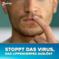 ZOVIRAX Lippenherpes Creme